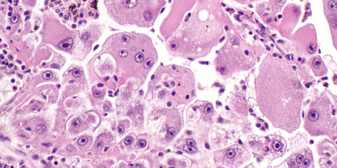 The Sigma-2 Receptor/TMEM97 Agonist PB28 Suppresses Cell Proliferation and Invasion by Regulating the PI3K-AKT-mTOR Signalling Pathway in Renal Cancer