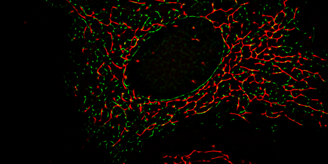 Intracellular dynamics of the Sigma-1 receptor observed with super-resolution imaging microscopy