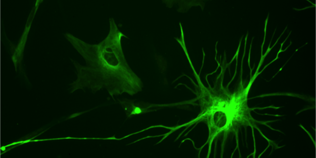 The Role of Astrocytes in the Neurorepair Process