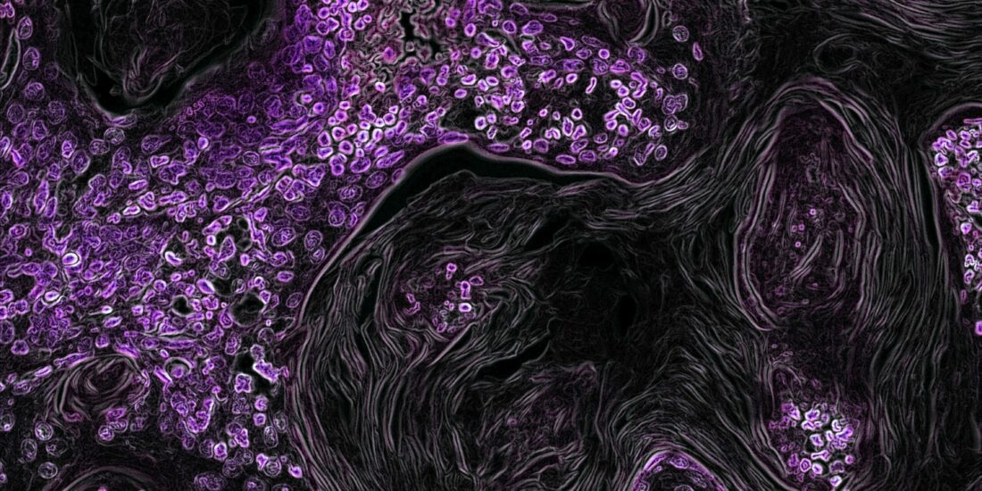 Sigma-1 Receptor Modulation by Ligands Coordinates Cancer Cell Energy Metabolism