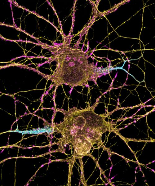Parkinson's neurons