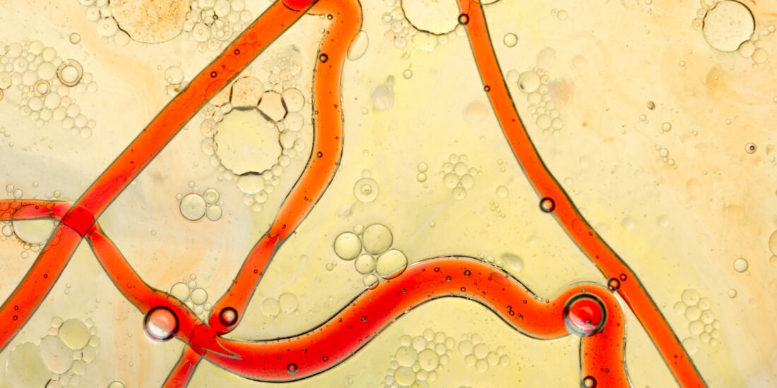 Progesterone Receptor Membrane Component-1 May Promote Survival of Human Brain Microvascular Endothelial Cells in Alzheimer’s Disease