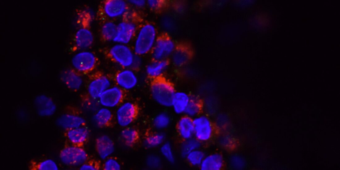 ORAI1 regulates sustained cytosolic free calcium fluctuations during breast cancer cell apoptosis and apoptotic resistance via a STIM1 independent pathway