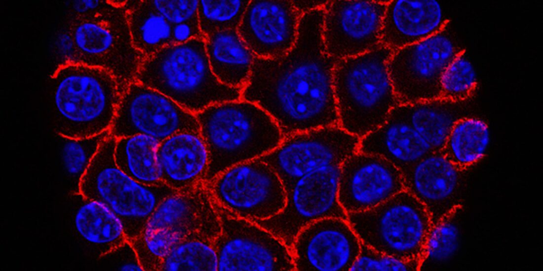 New Pharmacological Strategies against Pancreatic Adenocarcinoma: The Multifunctional Thiosemicarbazone FA4