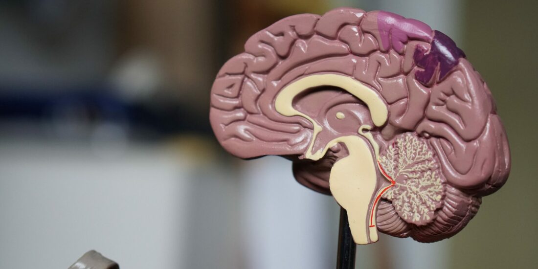 Earlier Alzheimer’s disease onset is associated with tau pathology in brain hub regions and facilitated tau spreading