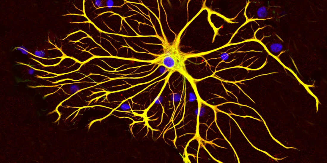 Protein synthesis inhibition and loss of homeostatic functions in astrocytes from an Alzheimer’s disease mouse model: a role for ER-mitochondria interaction