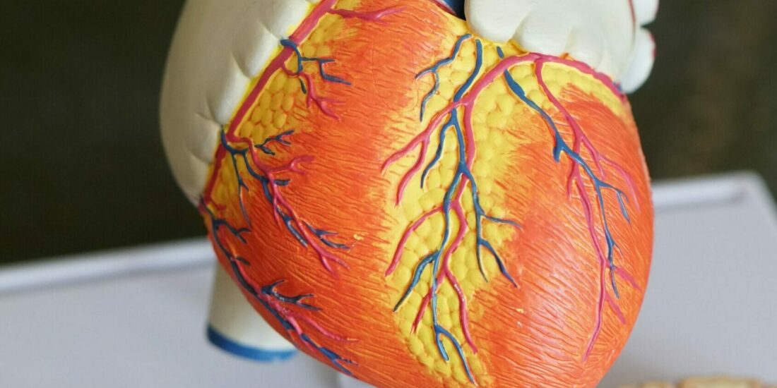 The Role of the Sigma-2 Receptor in Myocardial Ischemia-Reperfusion Injury